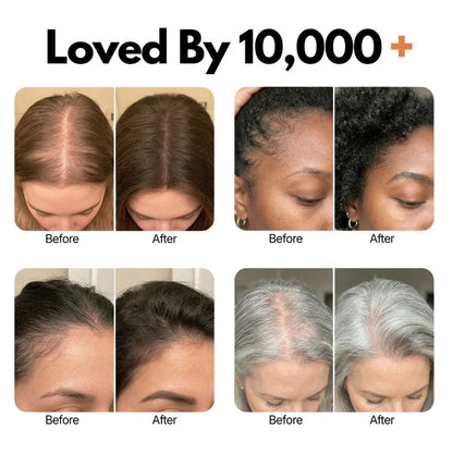 Hair Growth Serum