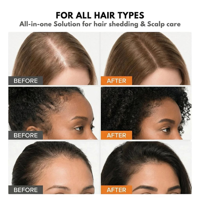 Hair Growth Serum