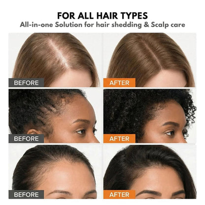 Hair Growth Serum